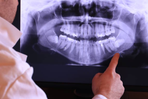 Best Emergency Tooth Extraction in New York Mills, MN